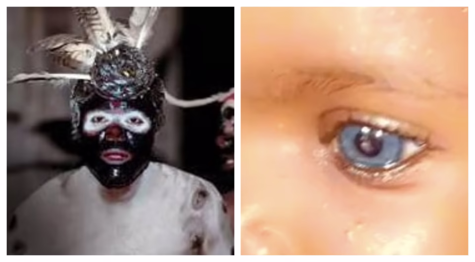 Que faire si votre nouveau-né a les yeux bleu ciel et une ligne étrange sur la main ?